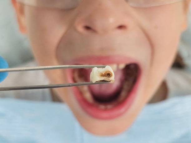 Best Emergency Dental Services for Seniors in Mcmechen, WV