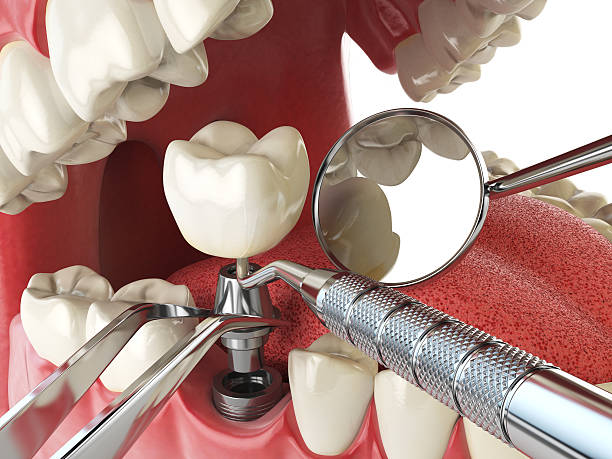 Best Emergency Dentist for Special Needs Patients in Mcmechen, WV
